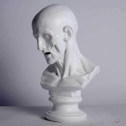 [src: https://orlandi-production.s3.amazonaws.com/images/882/original.jpg]